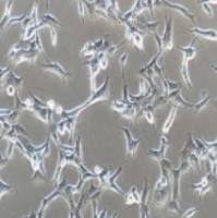 BCPAP 人甲状腺癌细胞(乳头状)