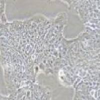 RT4 人膀胱移行细胞乳头瘤