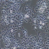 HO-8910PM 人高转移卵巢癌细胞