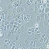 SW-13 人肾上腺皮质癌细胞