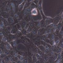 TPC-1 人乳头状甲状腺癌细胞