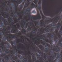 TPC-1 人乳头状甲状腺癌细胞