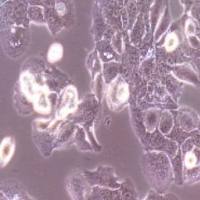 HT-1376 人膀胱癌细胞