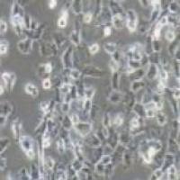 MUM2B 人侵袭性脉络膜黑色素瘤细胞