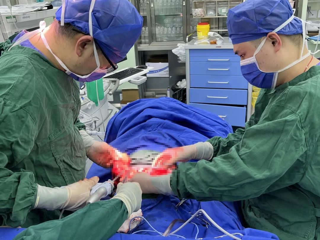江西省儿童医院成功实施精准「保脾」的脾肿瘤切除术