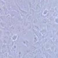 SRA01/04 人晶体上皮细胞