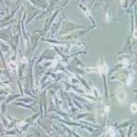 OCM1A 人眼脉络黑色素瘤细胞