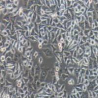 HELA-S3 人宫颈癌细胞