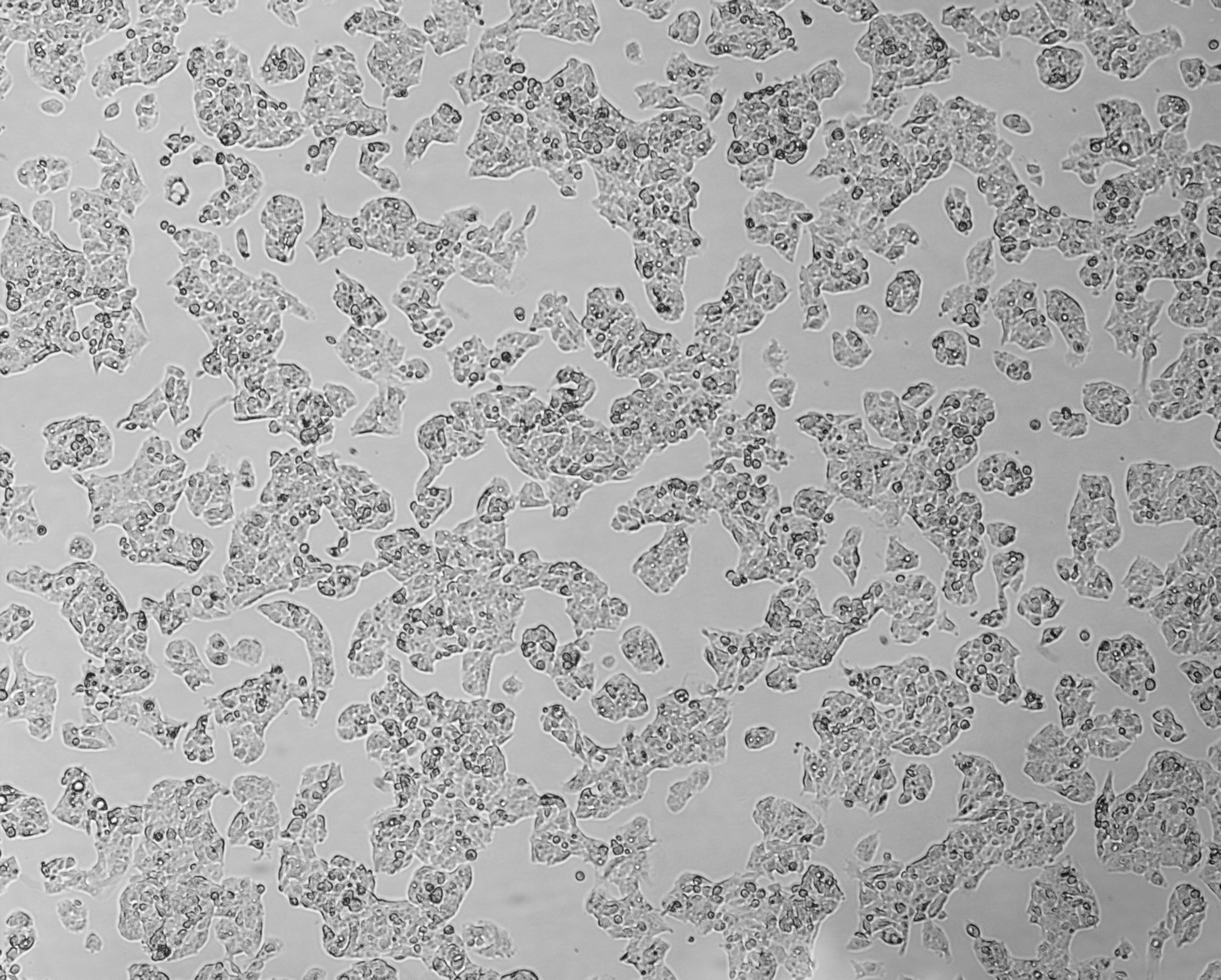 细胞攻略 | HepG2(人肝癌细胞)培养教程