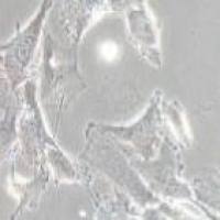 SW579 人甲状腺癌细胞