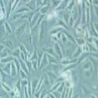 EJ (EJ-1)人膀胱癌细胞