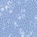 HCC-94 人子宫鳞癌细胞(高分化)