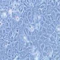 HCC-94 人子宫鳞癌细胞(高分化)