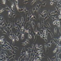 ES-2 人卵巢透明细胞癌细胞