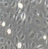 CASKI 人宫颈癌细胞