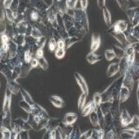 OVCAR-3 人卵巢腺癌细胞