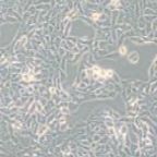 RT112 人膀胱癌细胞