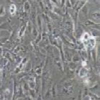 J82 人膀胱移行细胞癌