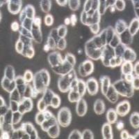 MDA-MB-468 人乳腺癌细胞