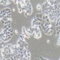 T47D 人乳腺导管癌细胞