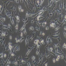 BT-549 人乳腺管癌细胞