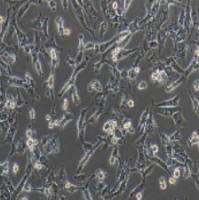 BT-549 人乳腺管癌细胞