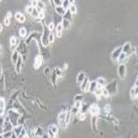 SK-BR-3 人乳腺腺癌细胞