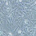 HEY 人卵巢癌细胞