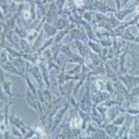 HEY 人卵巢癌细胞