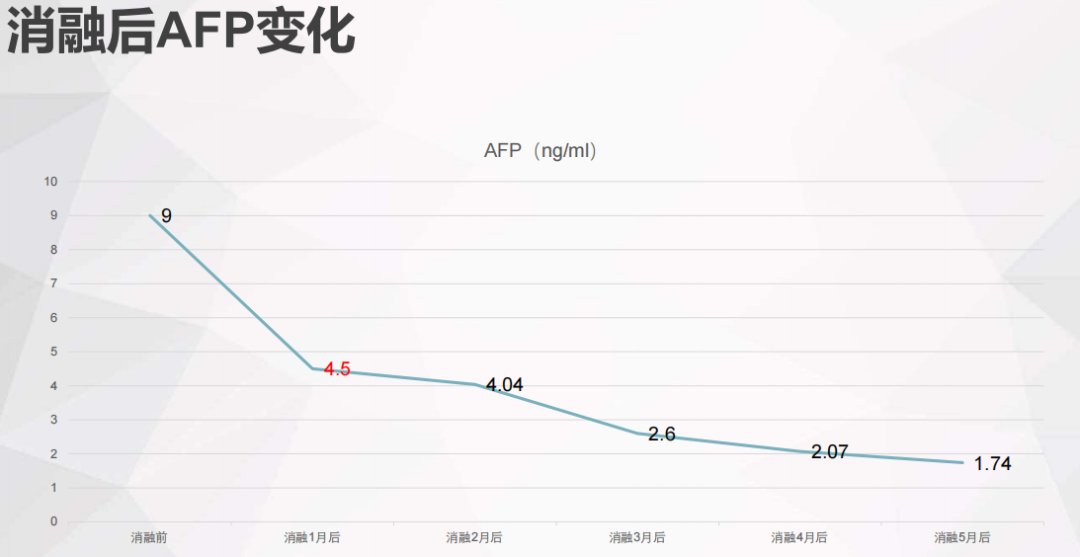 罗湖医院普外科专家团队为晚期肝癌患者开展综合治疗探索