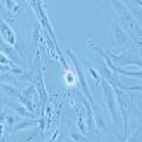 SW-1353 人骨肉瘤细胞