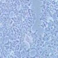 NCCIT 人畸胎癌细胞