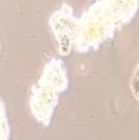ZR-75-1 人乳腺癌细胞