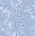 TOV-112D 人上皮性卵巢癌细胞