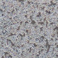 MDA-MB-453 人乳腺癌细胞