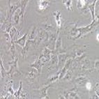 HS578T 人乳腺癌细胞