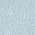KGN 人卵巢颗粒细胞瘤细胞