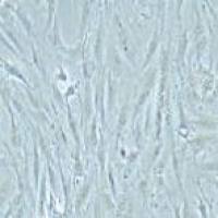 KGN 人卵巢颗粒细胞瘤细胞