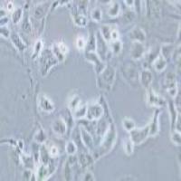 KLE 人子宫内膜癌细胞