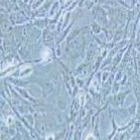 HEY A8 人卵巢癌细胞