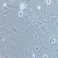 HCC38 乳腺导管癌细胞