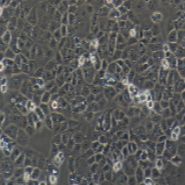 HEC-1-A 人子宫内膜腺癌细胞