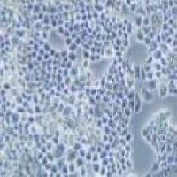 COV434 人卵巢颗粒肿瘤细胞