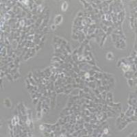 A673人横纹肌瘤细胞