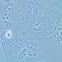 MDA-MB-415 人乳腺癌细胞