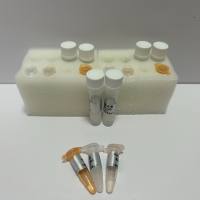 人腺病毒D22型探针法荧光定量PCR试剂盒