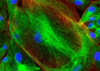 实验室干货：细胞免疫荧光实验重点叙述