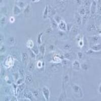 HCC1937 人乳腺癌细胞