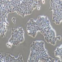 BT-474 人乳腺导管癌细胞