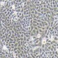 AV3 人宫颈癌细胞